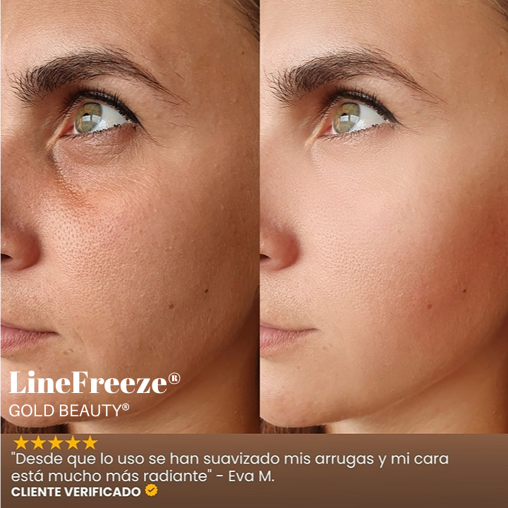 LineFreeze® - Crema Anti Edad